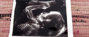 20 weken echo, echo, baby, zwanger, zwangerschap, mamablog, lifestyleblog, La Log